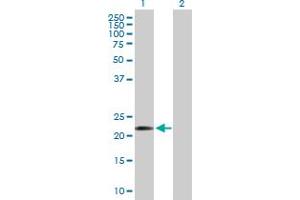 Western Blot analysis of COMMD10 expression in transfected 293T cell line by COMMD10 MaxPab polyclonal antibody. (COMMD10 抗体  (AA 1-202))