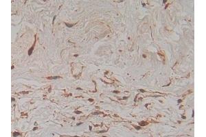 Immunohistochemistry (IHC) image for anti-Plasminogen Activator, Urokinase Receptor (PLAUR) (AA 13-114) antibody (ABIN7431179)