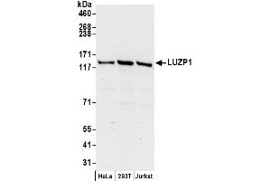 anti-Leucine Zipper Protein 1 (LUZP1) (AA 1-50) antibody