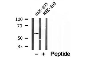 Western blot analysis of extracts of HEK-293 cells, using PPAT antibody. (PPAT 抗体  (N-Term))