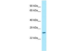 Western Blotting (WB) image for anti-Solute Carrier Family 17 Member 1 (SLC17A1) (N-Term) antibody (ABIN2789875) (SLC17A1 抗体  (N-Term))