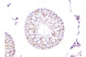 Immunohistochemistry of paraffin-embedded rat testis using RHOA/RHOB/RHOC Rabbit mAb (ABIN1678636, ABIN3019244, ABIN3019245 and ABIN7101735) at dilution of 1:100 (40x lens). (RhoA,B,C 抗体)