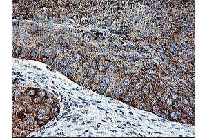 Image no. 2 for anti-Deoxythymidylate Kinase (Thymidylate Kinase) (DTYMK) antibody (ABIN1497918) (DTYMK 抗体)