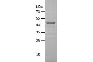 CTP Synthase Protein (CTPS) (AA 375-591) (His-IF2DI Tag)