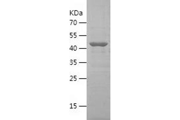 CTP Synthase Protein (CTPS) (AA 375-591) (His-IF2DI Tag)