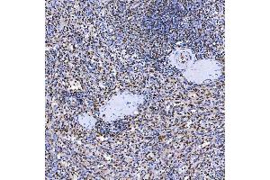 IHC analysis of SF3A3 using anti-SF3A3 antibody (ABIN7599863).