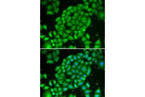 Immunofluorescence analysis of U2OS cell using TCL1A antibody. (TCL1A 抗体)