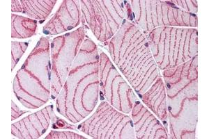 Human Skeletal Muscle: Formalin-Fixed, Paraffin-Embedded (FFPE) (ACTN2 抗体)