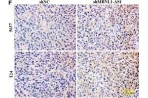 Inhibition of MBNL1-AS1 promoted the tumorigenesis of BC cells through the regulation of miR-135a/PHLPP2/FOXO1 in vivo. (Ki-67 抗体  (AA 700-800))