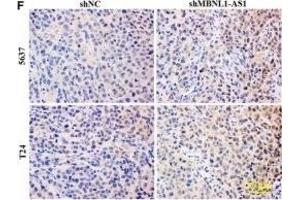 Inhibition of MBNL1-AS1 promoted the tumorigenesis of BC cells through the regulation of miR-135a/PHLPP2/FOXO1 in vivo. (Ki-67 抗体  (AA 700-800))