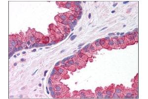 Human Prostate: Formalin-Fixed, Paraffin-Embedded (FFPE) (KLHL15 抗体  (C-Term))