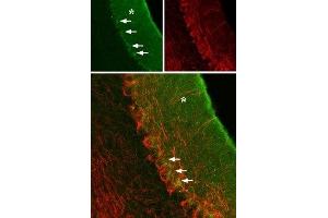 Immunohistochemistry (IHC) image for anti-gamma-aminobutyric Acid (GABA) A Receptor, alpha 3 (GABRA3) (AA 29-43), (Extracellular) antibody (ABIN7043187)