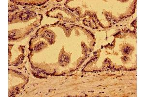 Immunohistochemistry of paraffin-embedded human prostate tissue using ABIN7159593 at dilution of 1:100 (MARS2 抗体  (AA 225-460))