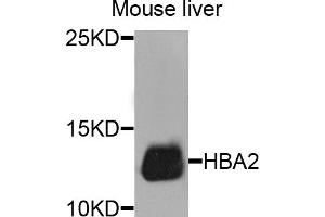 Western blot analysis of extracts of mouse liver, using HBA2 antibody. (HBa2 抗体)