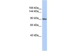 WB Suggested Anti-TNNI3K Antibody Titration:  0. (TNNI3K 抗体  (Middle Region))