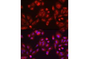 Immunohistochemistry of paraffin-embedded mouse testis using GALC antibody (ABIN1679950, ABIN3018222, ABIN3018224 and ABIN6220405) at dilution of 1:100 (40x lens). (GALC 抗体  (AA 40-300))