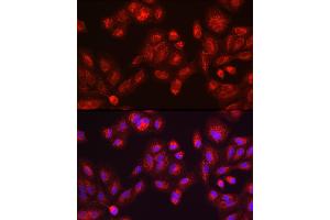 Immunohistochemistry of paraffin-embedded mouse testis using GALC antibody (ABIN1679950, ABIN3018222, ABIN3018224 and ABIN6220405) at dilution of 1:100 (40x lens). (GALC 抗体  (AA 40-300))