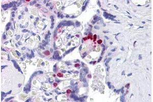 Human Placenta: Formalin-Fixed, Paraffin-Embedded (FFPE) (FOXO4 抗体  (N-Term))