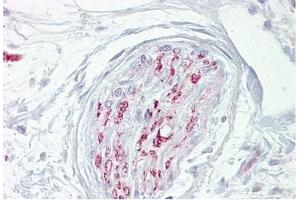 Nerve stained with CA2D1 Antibody in Immunohistochemistry on Paraffin Sections (CACNA2D1 抗体)
