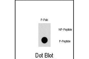 Dot blot analysis of Phospho-TSC2- polyclonal antibody (ABIN1881949 and ABIN2839674) on nitrocellulose membrane. (Tuberin 抗体  (pSer1387))