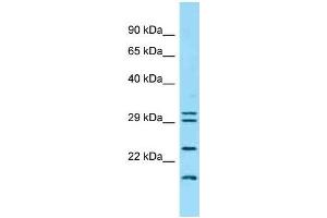 Western Blotting (WB) image for anti-Interferon, kappa (IFNK) (C-Term) antibody (ABIN2789152) (IFNK 抗体  (C-Term))