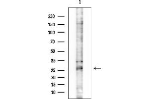Western blot analysis of lysates from COLO205 cells, using GPX5 Antibody at 1/1000 dilution.