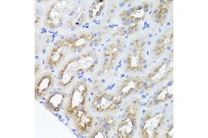 Immunohistochemistry of paraffin-embedded rat kidney using AMBRA1 antibody (ABIN5970441) at dilution of 1/100 (40x lens). (AMBRA1 抗体)