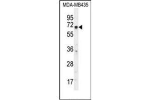 Western blot analysis of KCNQ1 Antibody (N-term) in MDA-MB435 cell line lysates (35ug/lane). (KCNQ1 抗体  (N-Term))