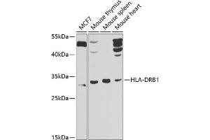 Western blot analysis of extracts of various cell lines, using HLA-DRB1 antibody (ABIN6131759, ABIN6141831, ABIN6141832 and ABIN6223610) at 1:1000 dilution.