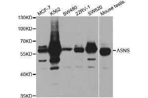 Western Blotting (WB) image for anti-Asparagine Synthetase (ASNS) antibody (ABIN1876738) (Asparagine Synthetase 抗体)