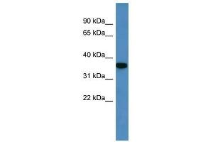 Western Blot showing Decr2 antibody used at a concentration of 1-2 ug/ml to detect its target protein. (DECR2 抗体  (C-Term))
