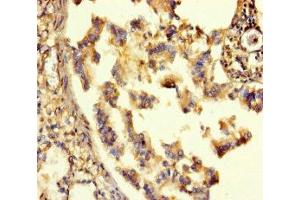 Immunohistochemistry of paraffin-embedded human lung tissue using ABIN7153489 at dilution of 1:100 (GABRA6 抗体  (AA 20-242))