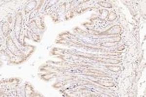 Immunohistochemistry analysis of paraffin-embedded rat colon using,TORC1 (ABIN7073590) at dilution of 1: 800 (CRTC1 抗体)