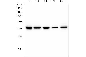 Western blot analysis of CD160 using anti-CD160 antibody (ABIN6719459).