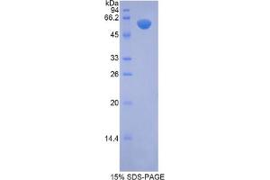 SDS-PAGE analysis of Mouse NAGLU Protein. (N-Acetyl alpha-D-Glucosaminidase 蛋白)