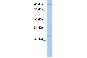 WB Suggested Anti-OSBPL8 Antibody Titration:  0. (OSBPL8 抗体  (N-Term))