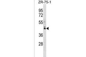 PCMTD2 Antibody (C-term) (ABIN1536944 and ABIN2849981) western blot analysis in ZR-75-1 cell line lysates (35 μg/lane). (PCMTD2 抗体  (C-Term))