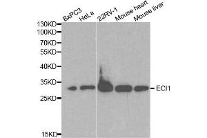 Western blot analysis of extracts of various cell lines, using ECI1 antibody. (DCI 抗体)