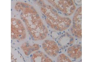 Used in DAB staining on fromalin fixed paraffin- embedded Kidney tissue (LAMC2 抗体  (AA 28-196))