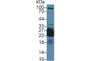 Detection of SHISA4 in Mouse Cerebrum lysate using Polyclonal Antibody to Shisa Homolog 4 (SHISA4)