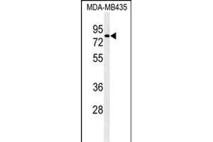 Western blot analysis of ATHL1 Antibody (C-term) (ABIN1881084 and ABIN2840111) in MDA-M cell line lysates (35 μg/lane). (ATHL1 抗体  (C-Term))