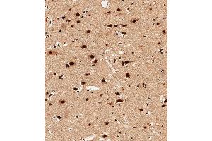 Immunohistochemistry (Paraffin-embedded Sections) (IHC (p)) image for anti-Small Nuclear Ribonucleoprotein D3 Polypeptide 18kDa (SNRPD3) (AA 9-38), (N-Term) antibody (ABIN656384)