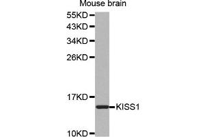 Western blot analysis of extracts of mouse brain, using KISS1 antibody (ABIN5971535). (KISS1 抗体)