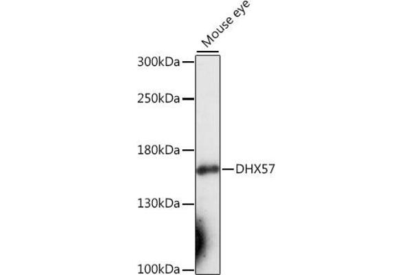 DHX57 抗体  (AA 700-900)