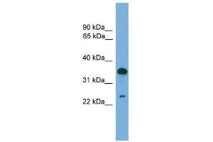 TPD52 antibody used at 0. (TPD52 抗体  (C-Term))