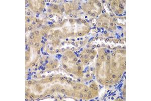 Immunohistochemistry of paraffin-embedded mouse kidney using RPL5 antibody (ABIN5971027) at dilution of 1/200 (40x lens). (RPL5 抗体)