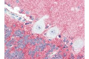 Human Brain, Cerebellum (formalin-fixed, paraffin-embedded) stained with SLITRK2at 5 µg/ml followed by biotinylated goat anti-rabbit IgG secondary antibody, alkaline phosphatase-streptavidin and chromogen. (SLITRK2 抗体  (C-Term))