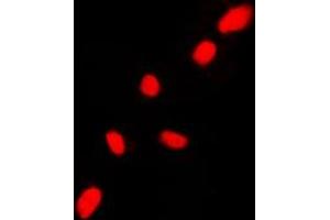 Immunofluorescent analysis of CHK2 staining in HL60 cells. (CHEK2 抗体  (N-Term))