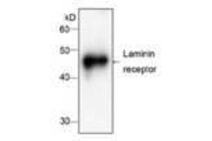 Image no. 1 for anti-Ribosomal Protein SA (RPSA) antibody (ABIN791537) (RPSA/Laminin Receptor 抗体)