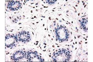 Immunohistochemical staining of paraffin-embedded breast tissue using anti-BRAF mouse monoclonal antibody. (BRAF 抗体)